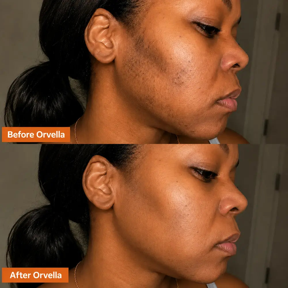 Orvella Pumpkin Seed Oil & Saw Palmetto