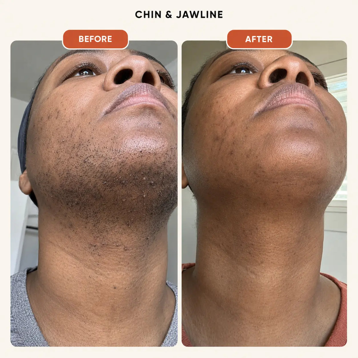 Orvella Pumpkin Seed Oil & Saw Palmetto Softgels