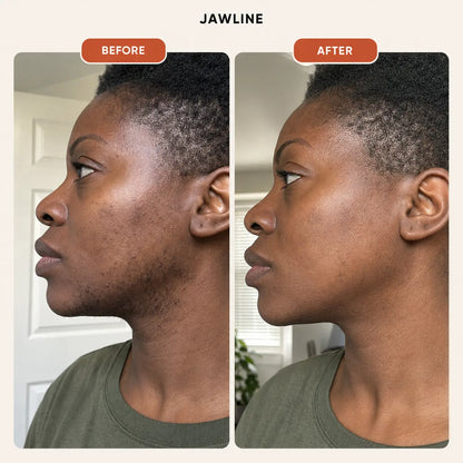Orvella Pumpkin Seed Oil & Saw Palmetto Softgels